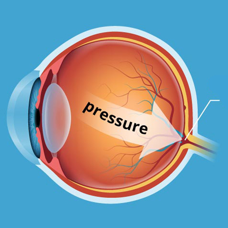 Glaucoma Service